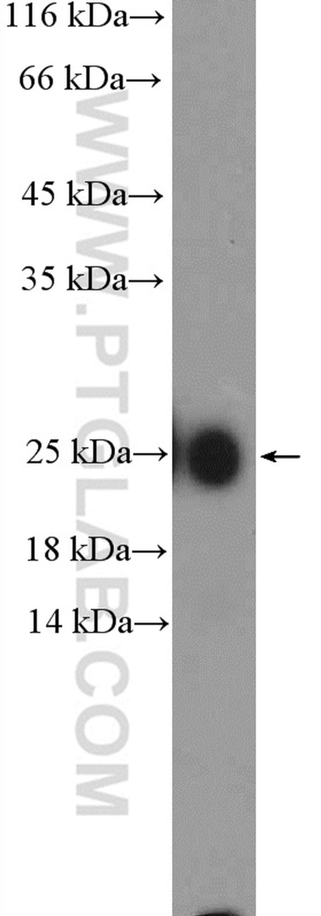 IgG light chain (Kappa) Antibody in Western Blot (WB)