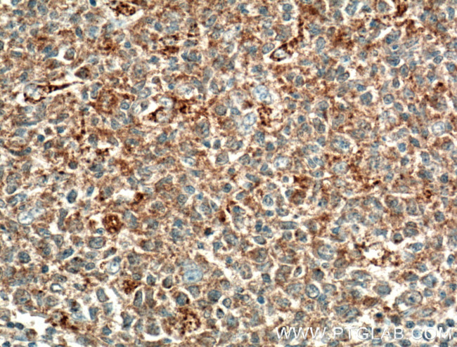 Eotaxin Antibody in Immunohistochemistry (Paraffin) (IHC (P))