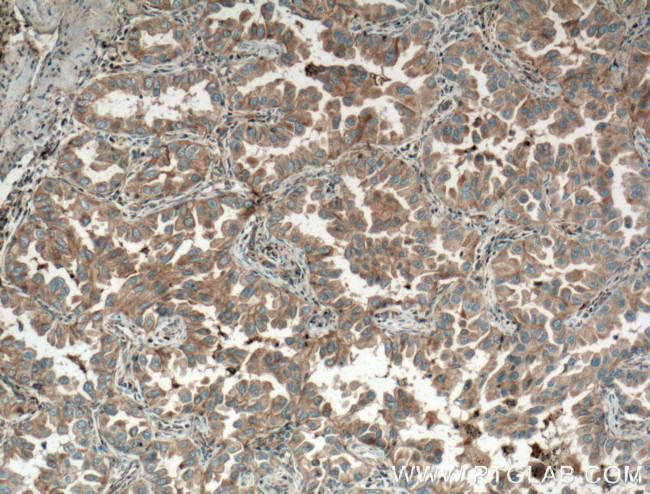 Eotaxin Antibody in Immunohistochemistry (Paraffin) (IHC (P))