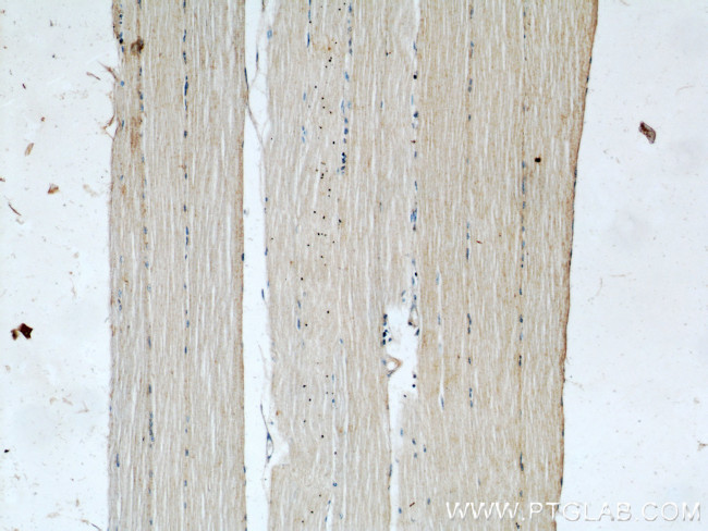 POPDC3 Antibody in Immunohistochemistry (Paraffin) (IHC (P))