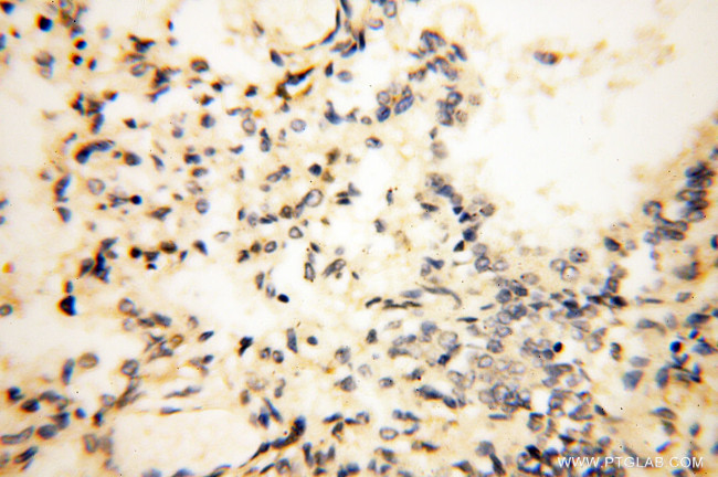 POPDC3 Antibody in Immunohistochemistry (Paraffin) (IHC (P))