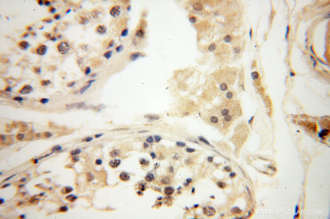 POPDC3 Antibody in Immunohistochemistry (Paraffin) (IHC (P))