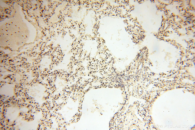 POPDC3 Antibody in Immunohistochemistry (Paraffin) (IHC (P))