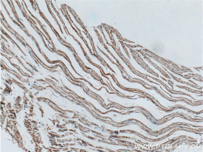 POPDC3 Antibody in Immunohistochemistry (Paraffin) (IHC (P))