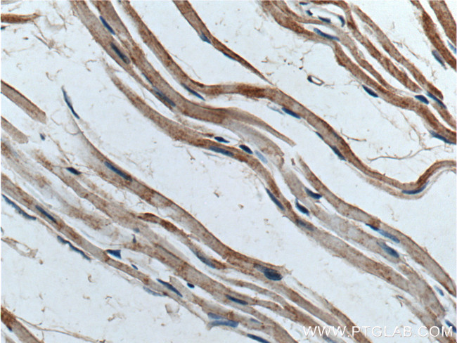 POPDC3 Antibody in Immunohistochemistry (Paraffin) (IHC (P))