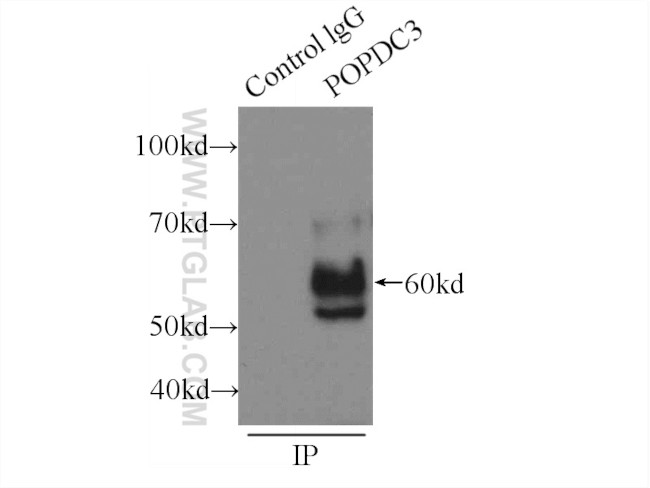 POPDC3 Antibody in Immunoprecipitation (IP)