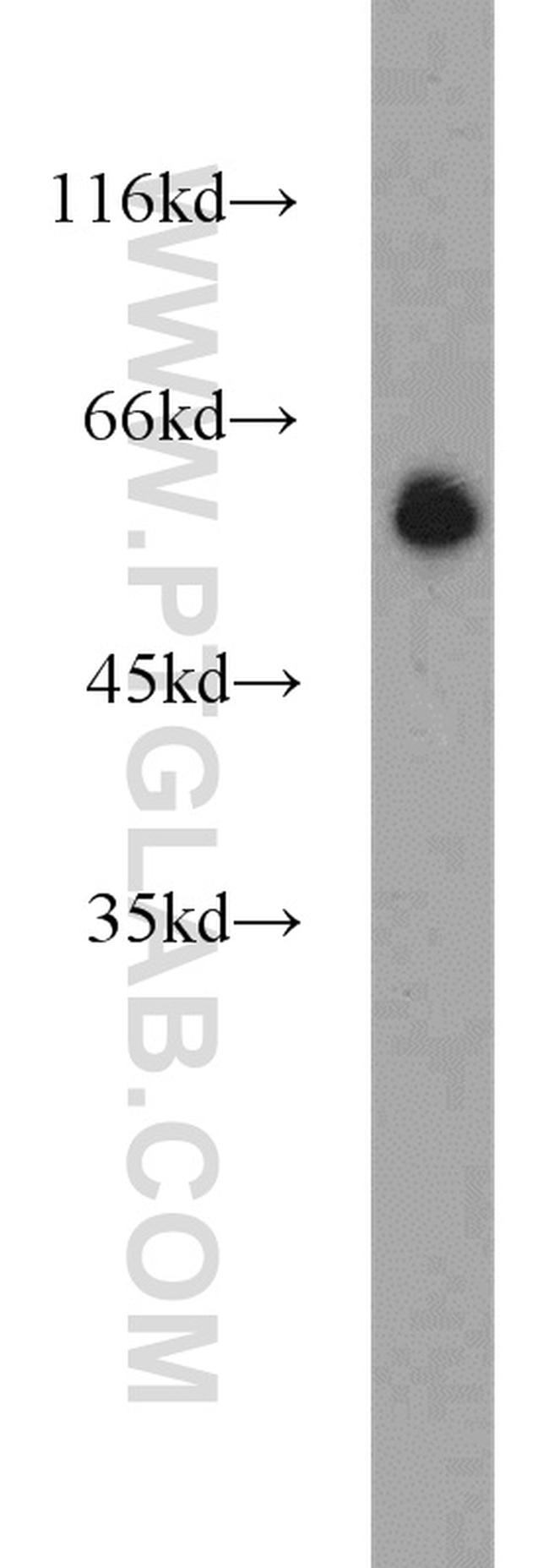 POPDC3 Antibody in Western Blot (WB)