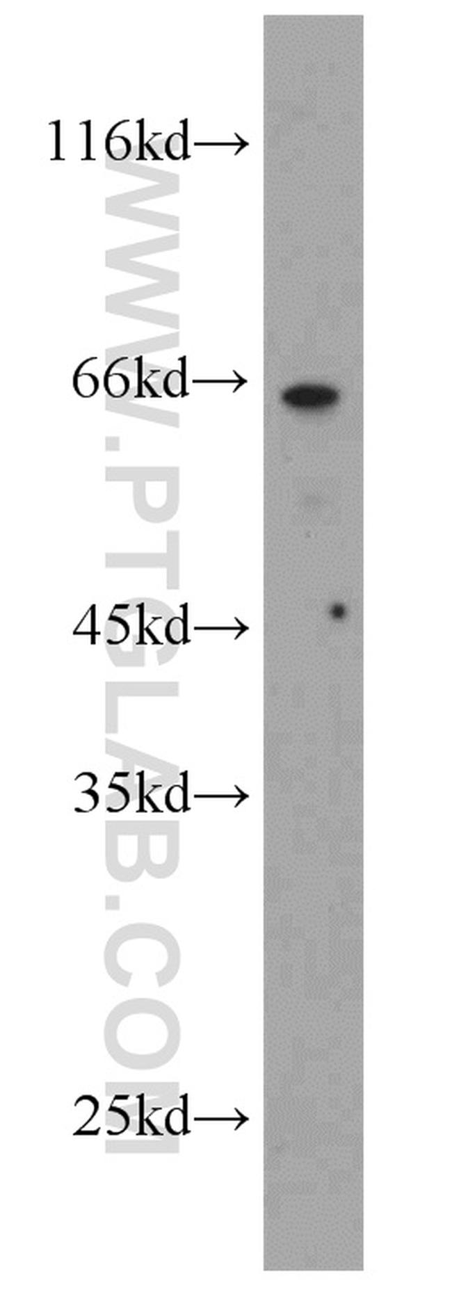 POPDC3 Antibody in Western Blot (WB)