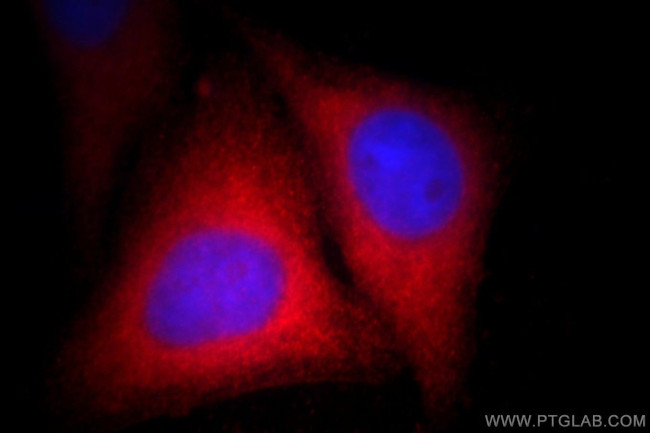 S100P Antibody in Immunocytochemistry (ICC/IF)