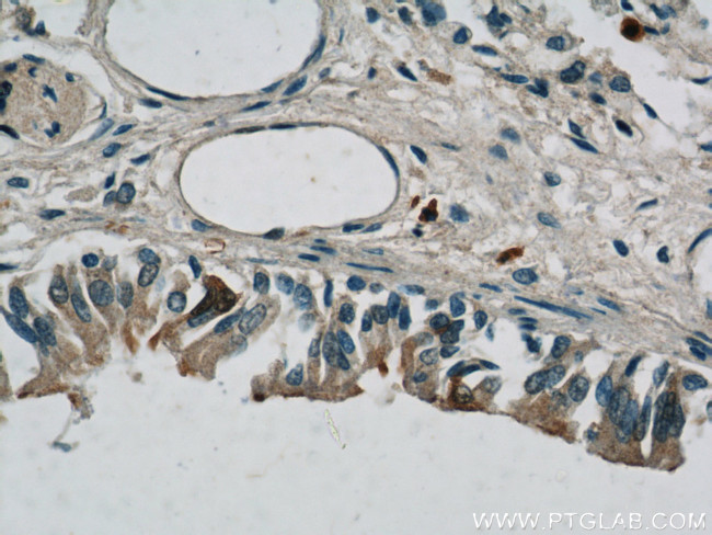 S100P Antibody in Immunohistochemistry (Paraffin) (IHC (P))