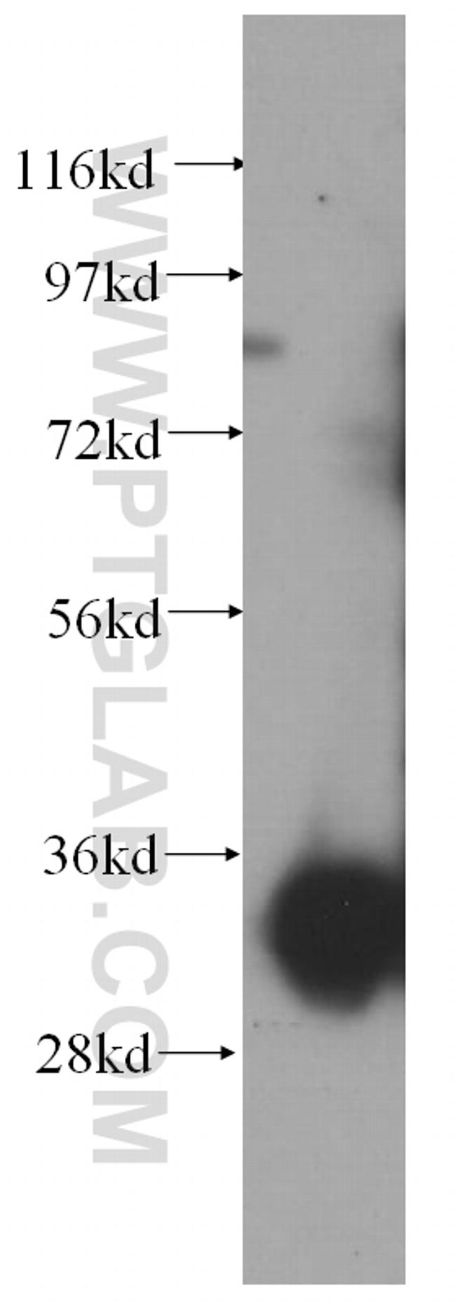 CYB5R1 Antibody in Western Blot (WB)