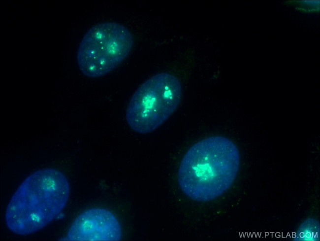 NOLC1 Antibody in Immunocytochemistry (ICC/IF)