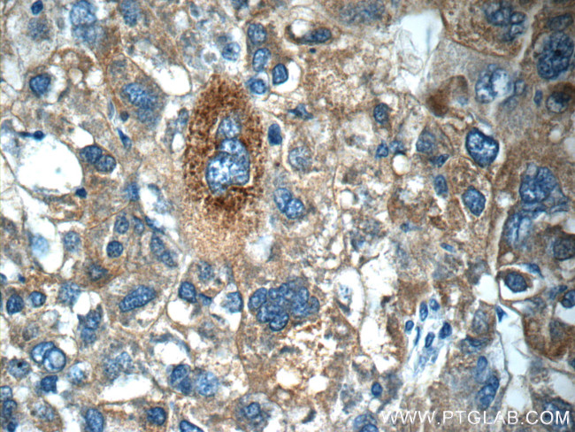 C4BPA Antibody in Immunohistochemistry (Paraffin) (IHC (P))