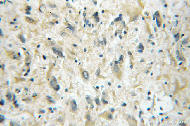 FBXO6 Antibody in Immunohistochemistry (Paraffin) (IHC (P))