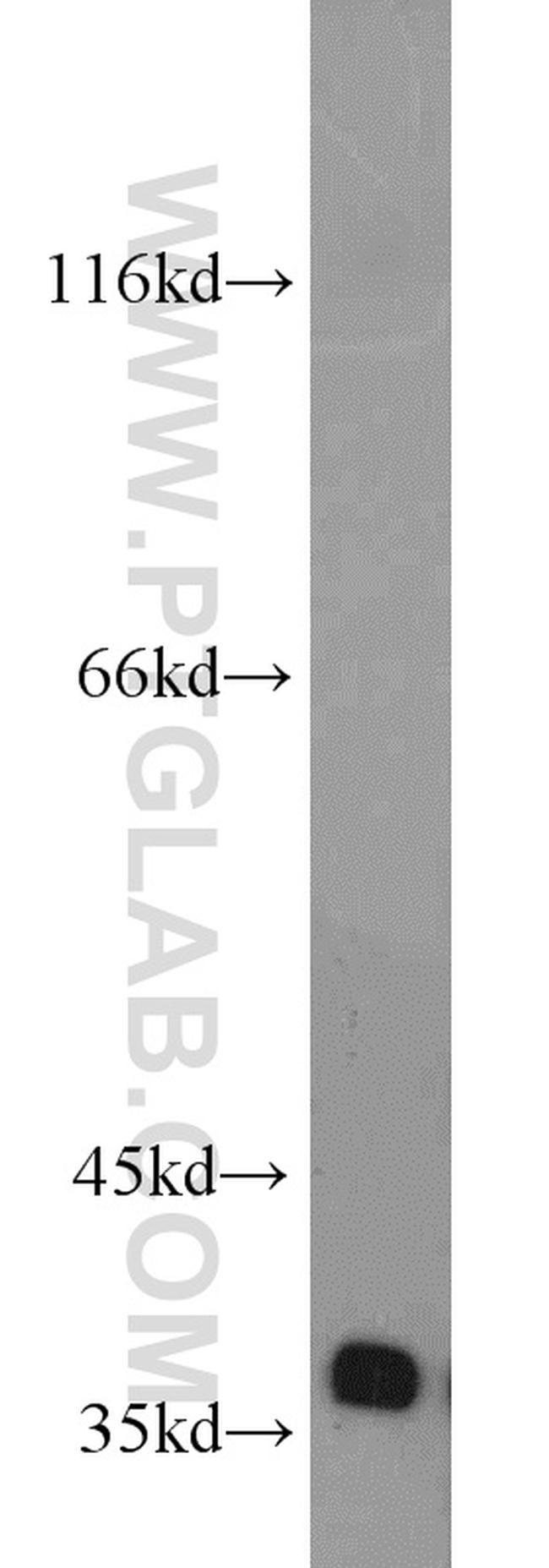 FBXO6 Antibody in Western Blot (WB)