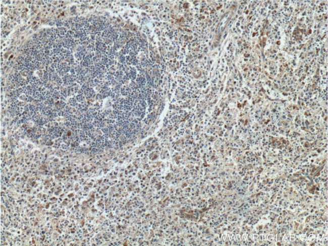 GBP2 Antibody in Immunohistochemistry (Paraffin) (IHC (P))