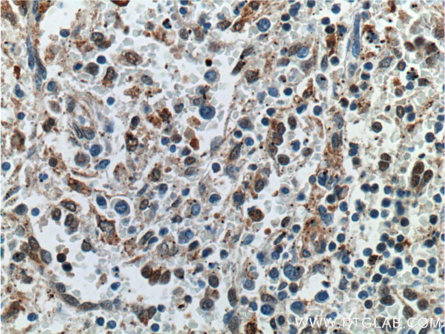 GBP2 Antibody in Immunohistochemistry (Paraffin) (IHC (P))