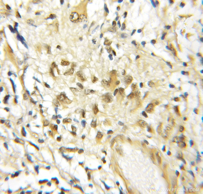 BRD3 Antibody in Immunohistochemistry (Paraffin) (IHC (P))