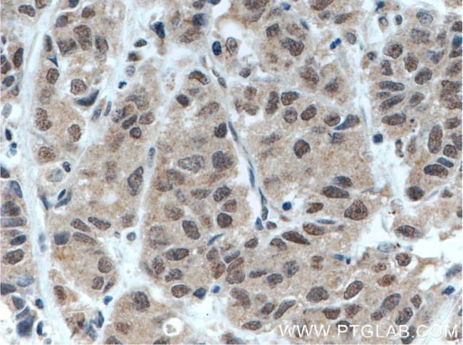 BRD3 Antibody in Immunohistochemistry (Paraffin) (IHC (P))