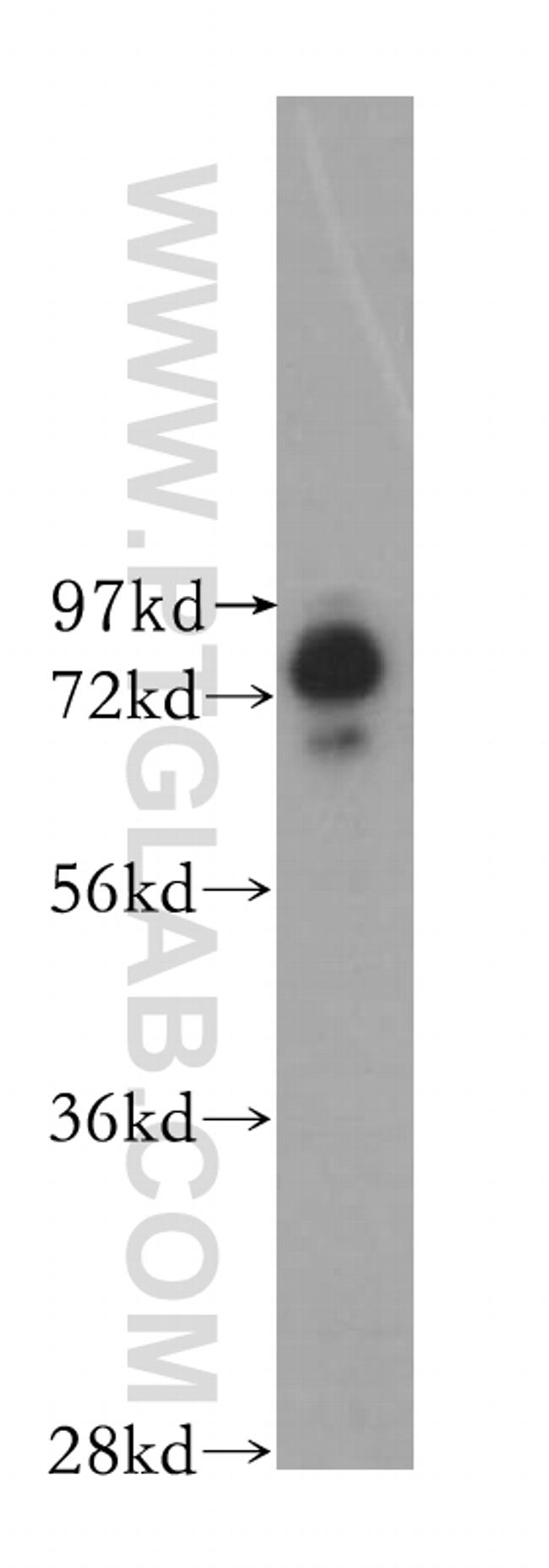 BRD3 Antibody in Western Blot (WB)