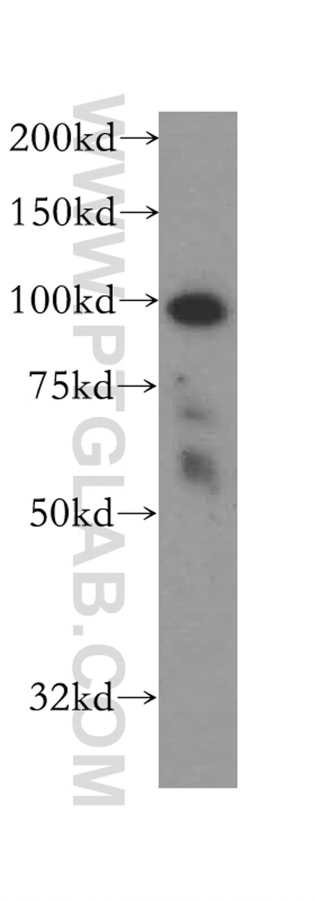 BRD3 Antibody in Western Blot (WB)