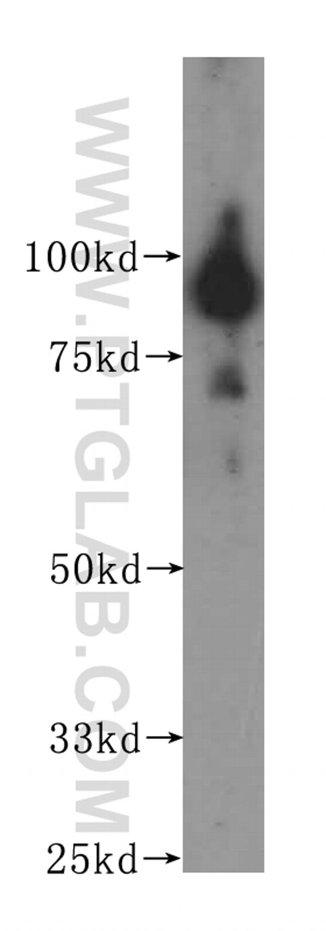 BRD3 Antibody in Western Blot (WB)