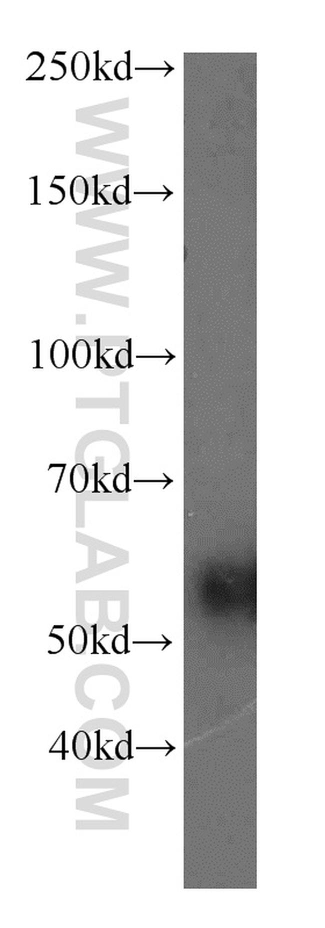 RAMP3 Antibody in Western Blot (WB)