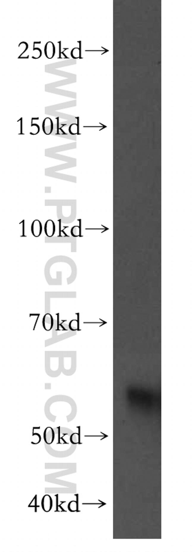 RAMP3 Antibody in Western Blot (WB)