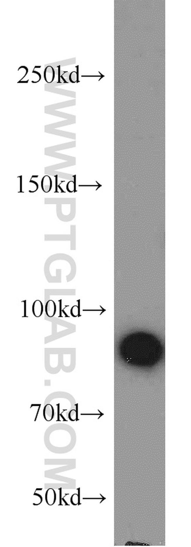 AGGF1 Antibody in Western Blot (WB)