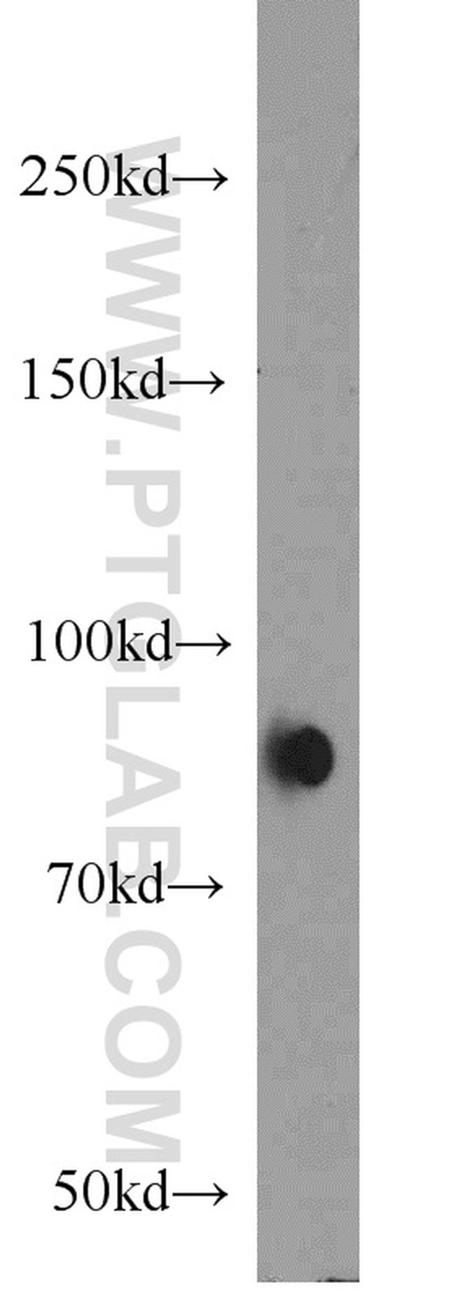 AGGF1 Antibody in Western Blot (WB)