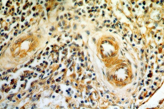 AGGF1 Antibody in Immunohistochemistry (Paraffin) (IHC (P))