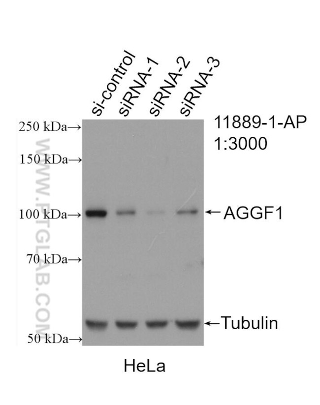 AGGF1 Antibody in Western Blot (WB)