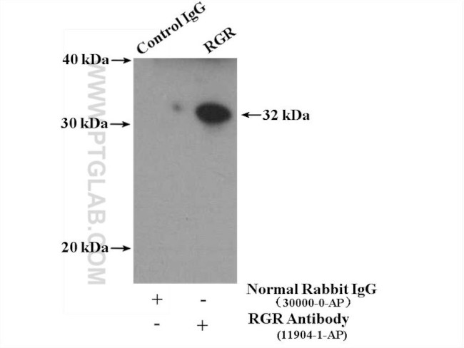 RGR Antibody in Immunoprecipitation (IP)