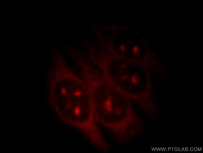 RNF7 Antibody in Immunocytochemistry (ICC/IF)