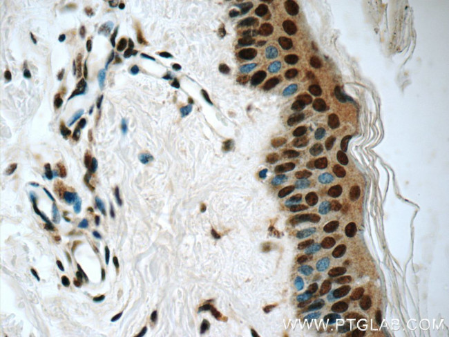 HuR Antibody in Immunohistochemistry (Paraffin) (IHC (P))