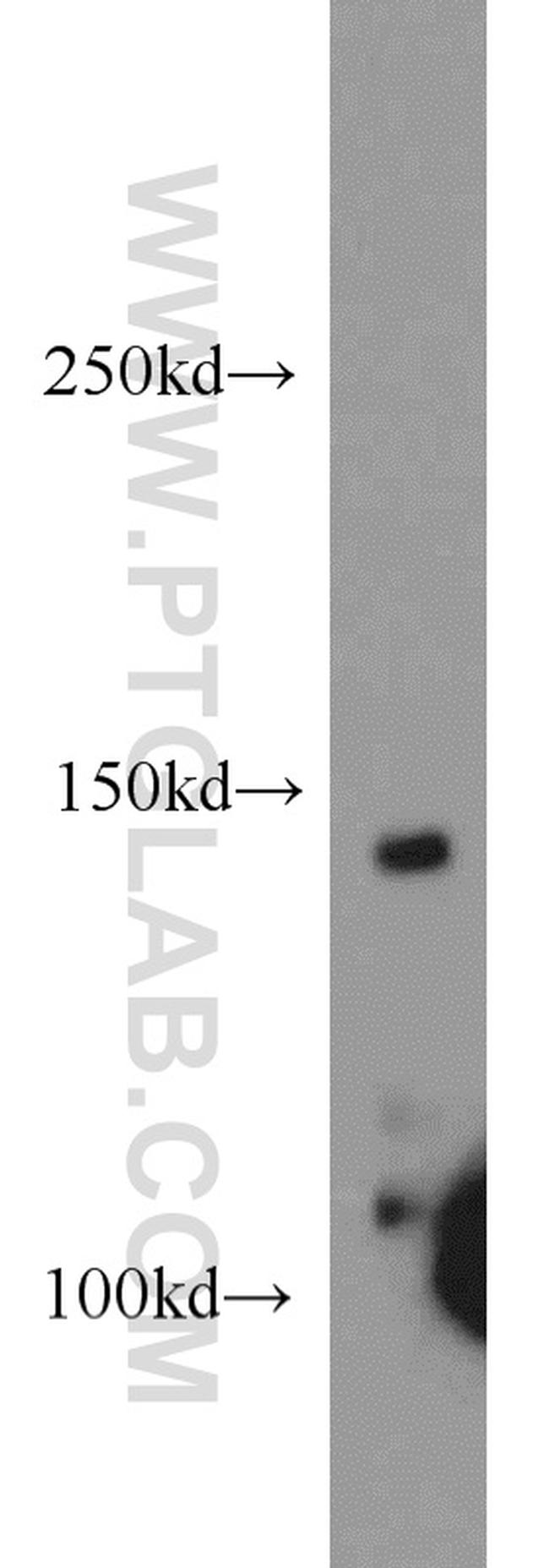 CSPP1 Antibody in Western Blot (WB)