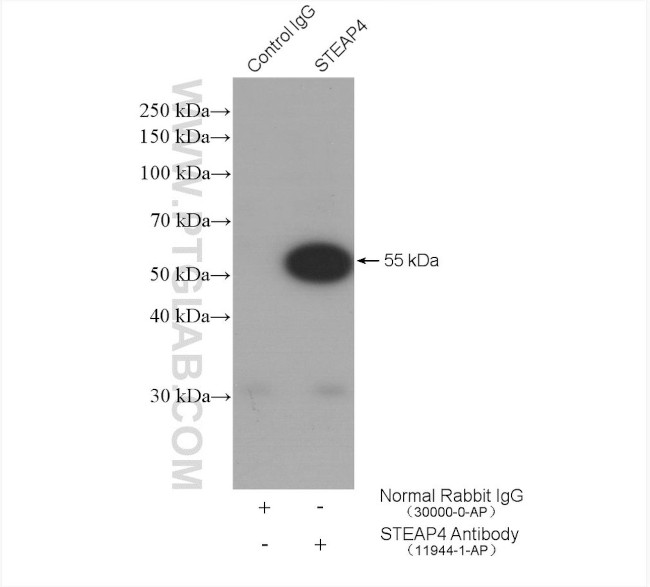 STEAP4 Antibody in Immunoprecipitation (IP)