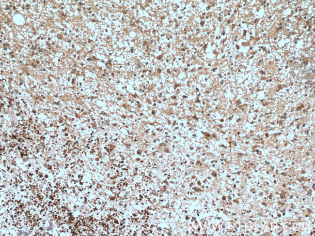 RAB5A Antibody in Immunohistochemistry (Paraffin) (IHC (P))