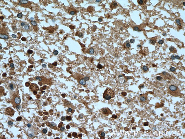 RAB5A Antibody in Immunohistochemistry (Paraffin) (IHC (P))