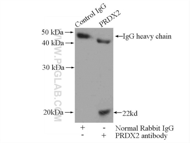 RAB5A Antibody in Immunoprecipitation (IP)