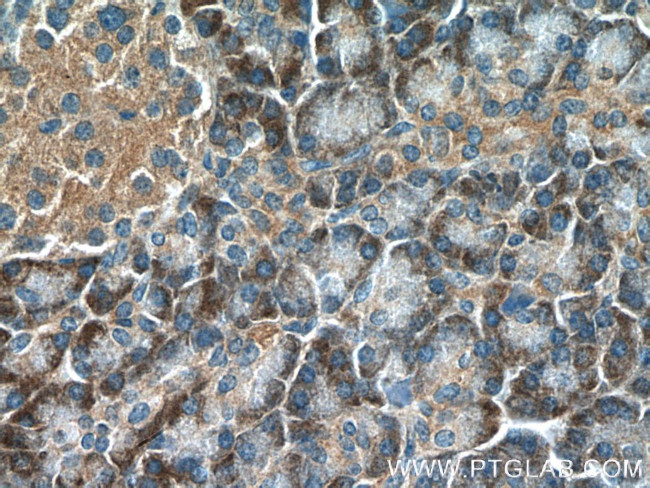 RAB5A Antibody in Immunohistochemistry (Paraffin) (IHC (P))