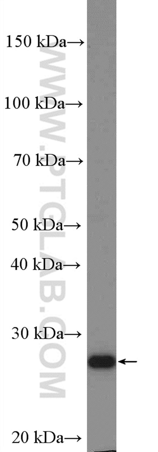 EMG1 Antibody in Western Blot (WB)