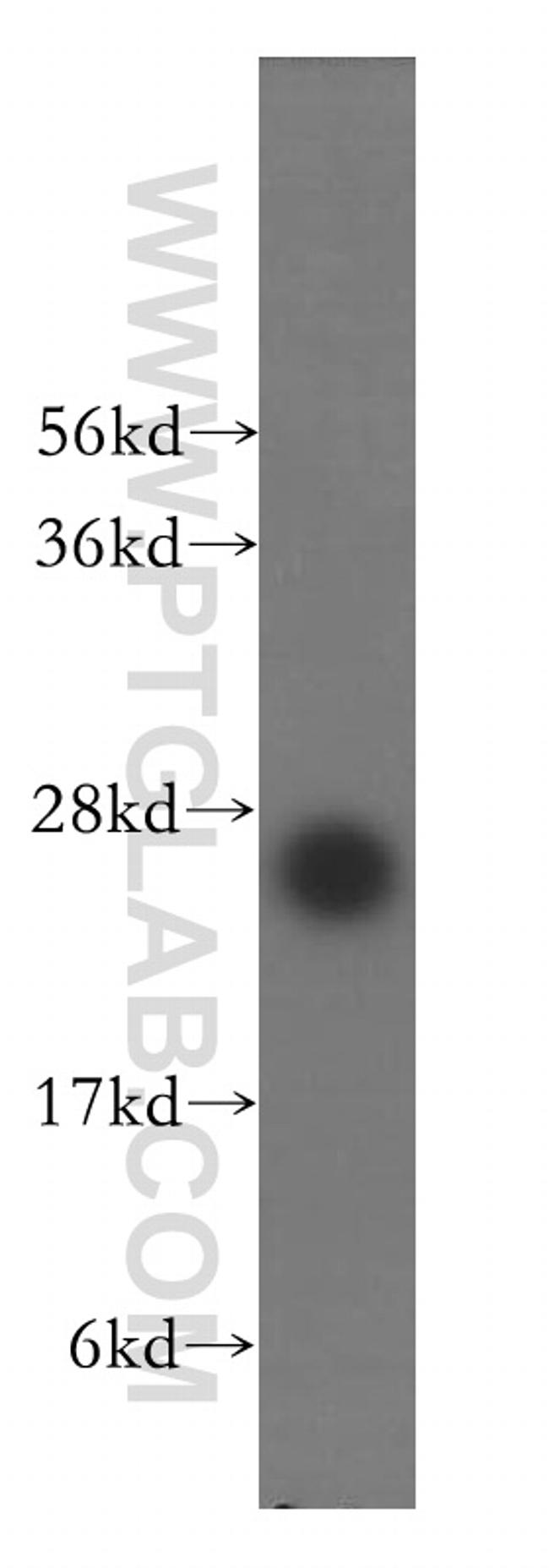 EMG1 Antibody in Western Blot (WB)