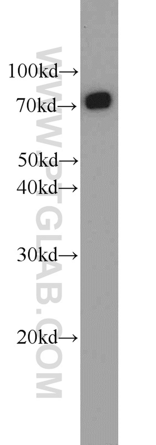 DNAJC2/MPP11 Antibody in Western Blot (WB)