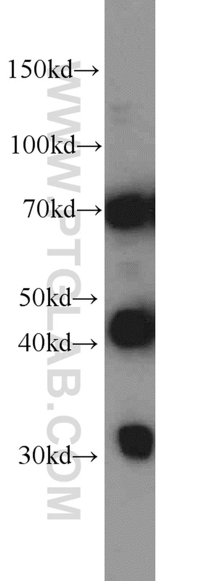 DNAJC2/MPP11 Antibody in Western Blot (WB)