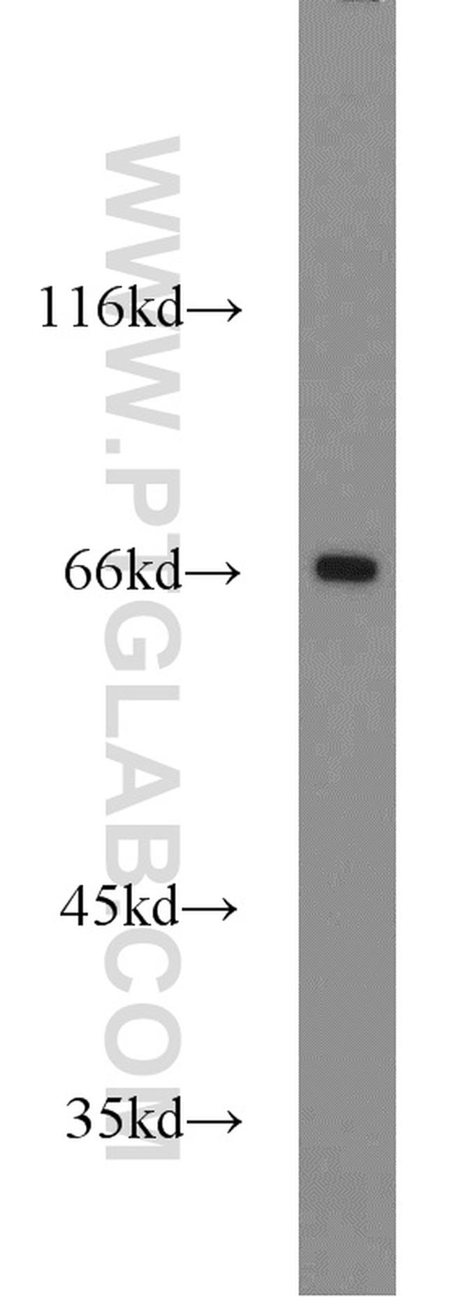 DNAJC2/MPP11 Antibody in Western Blot (WB)