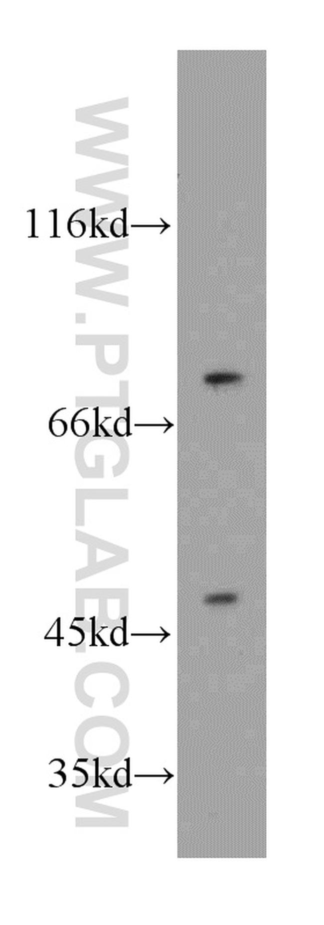 DNAJC2/MPP11 Antibody in Western Blot (WB)