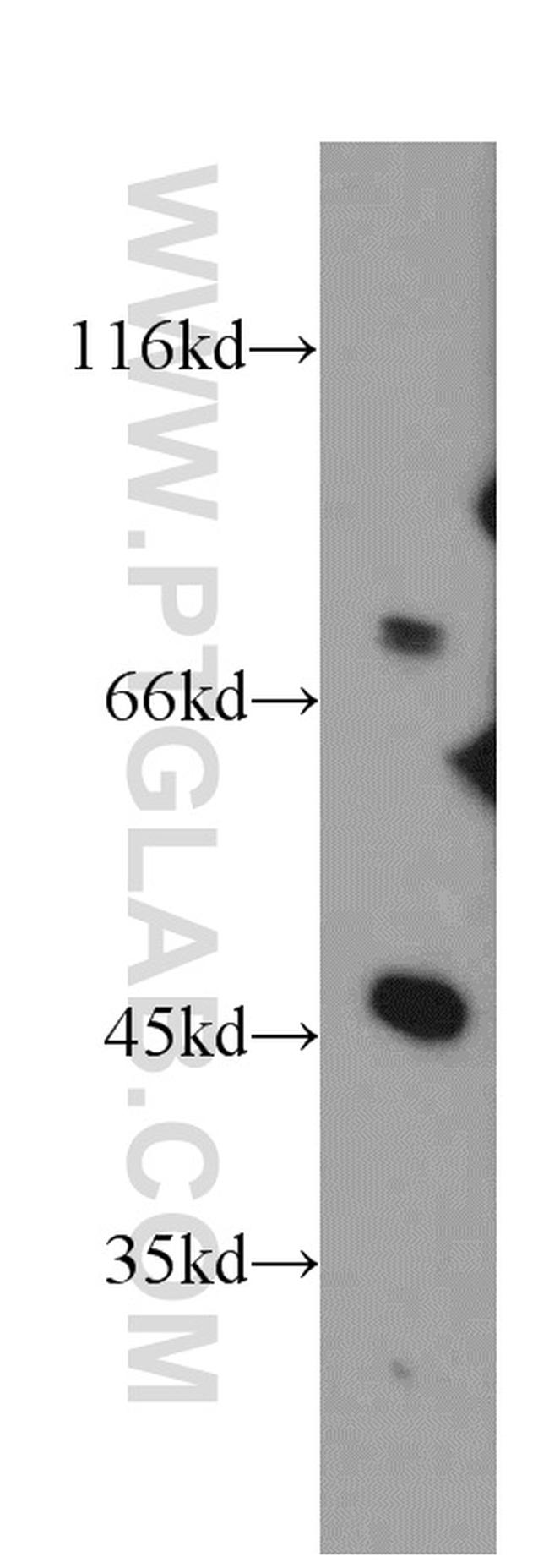 DNAJC2/MPP11 Antibody in Western Blot (WB)