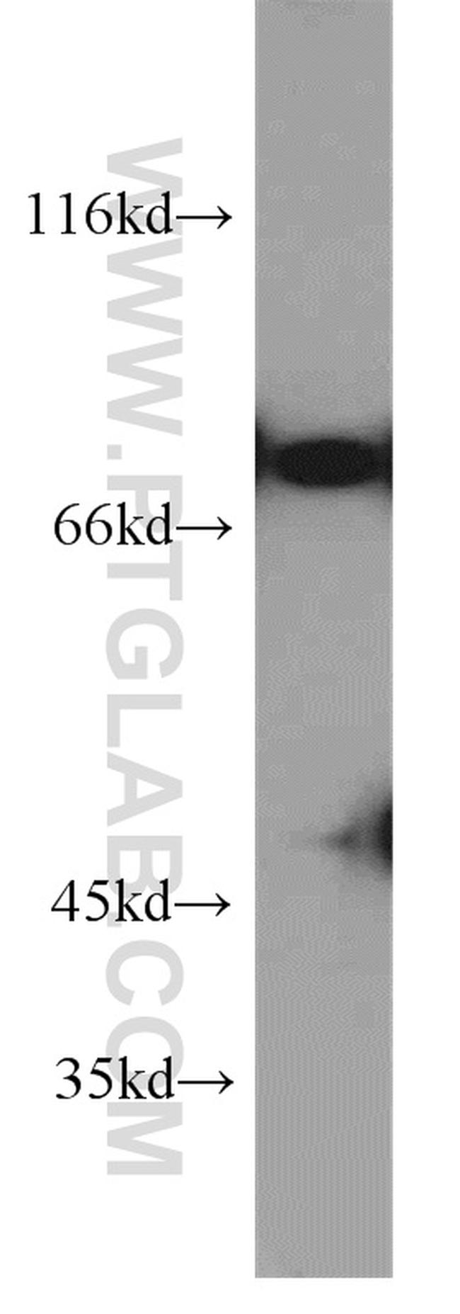 DNAJC2/MPP11 Antibody in Western Blot (WB)