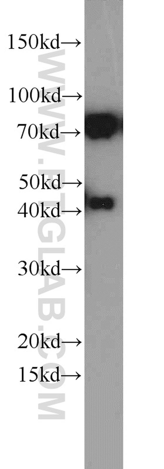 DNAJC2/MPP11 Antibody in Western Blot (WB)